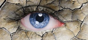 dry eye